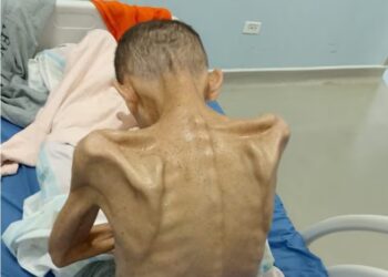 En hospital de Esmeraldas se evalúa salud de recluso expuesto en redes con extrema delgadez